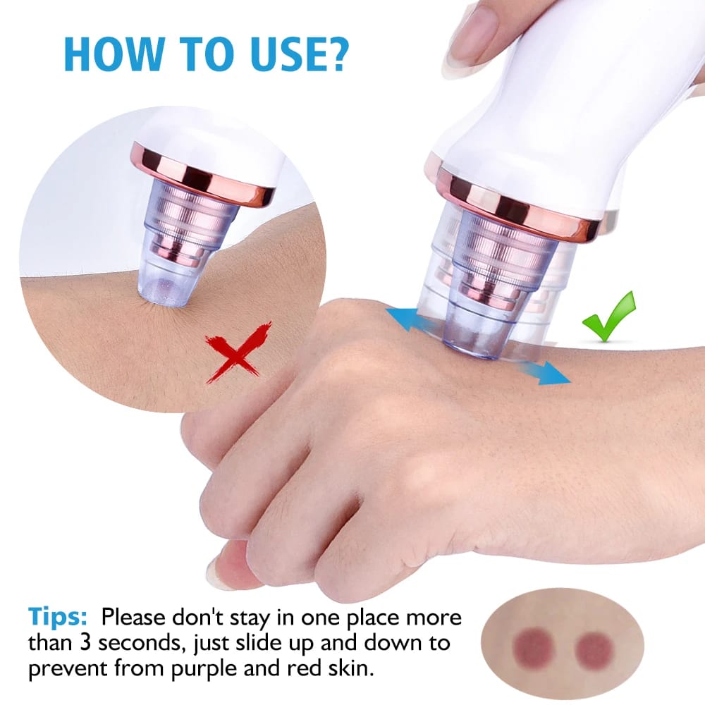 4-in-1 Blackhead remover | Multi-Functional | Rechargeable Suction