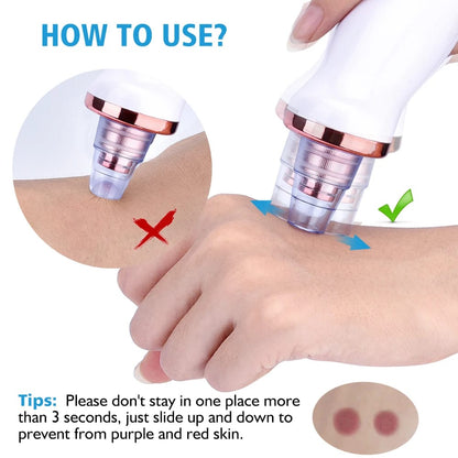 4-in-1 Blackhead remover | Multi-Functional | Rechargeable Suction